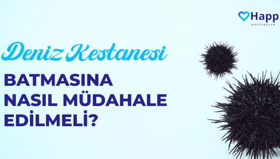 deniz kestanesi batması, deniz kestanesi tedavi, dermatolog tavsiyesi, deniz kestanesi dikenleri, cilt tedavisi