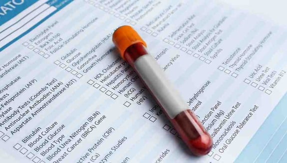 kan tahlili kısaltmaları, hemogram değerleri, biyokimya paneli, crp nedir, tsh nedir, ferritin nedir, check-up, online doktor, happ health