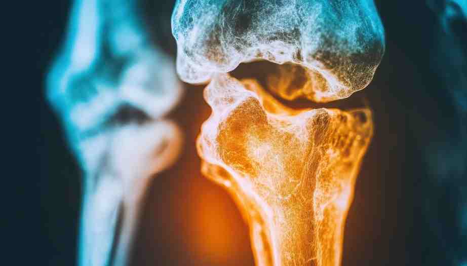 Kemik Sağlığı Neden Sessizce Kaybolur? Düzenli Değerlendirmenin Önemi