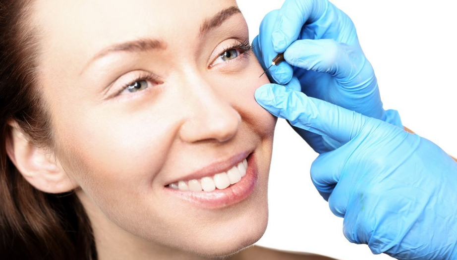 milia, milia nedir, milia tedavisi, milia nedenleri, cilt sağlığı, gözenek tıkanıklığı, cilt bakımı, beyaz noktalar, milia temizleme, sağlıklı cilt