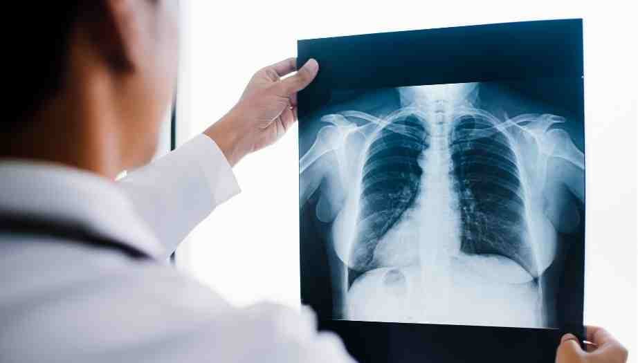 Check-Up’ta Akciğer Grafisi Neden Çekilir?