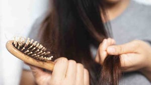 Saç Dökülmesi İçin Check-Up’ta Hangi Testler İstenir?
