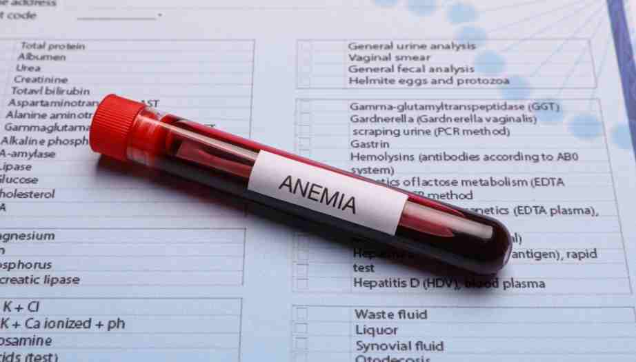 Kansızlık (Anemi) Nedir? Kansızlık Belirtileri Nelerdir? 