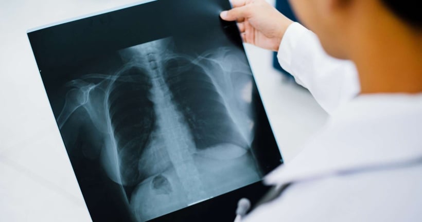 Home Chest X-ray