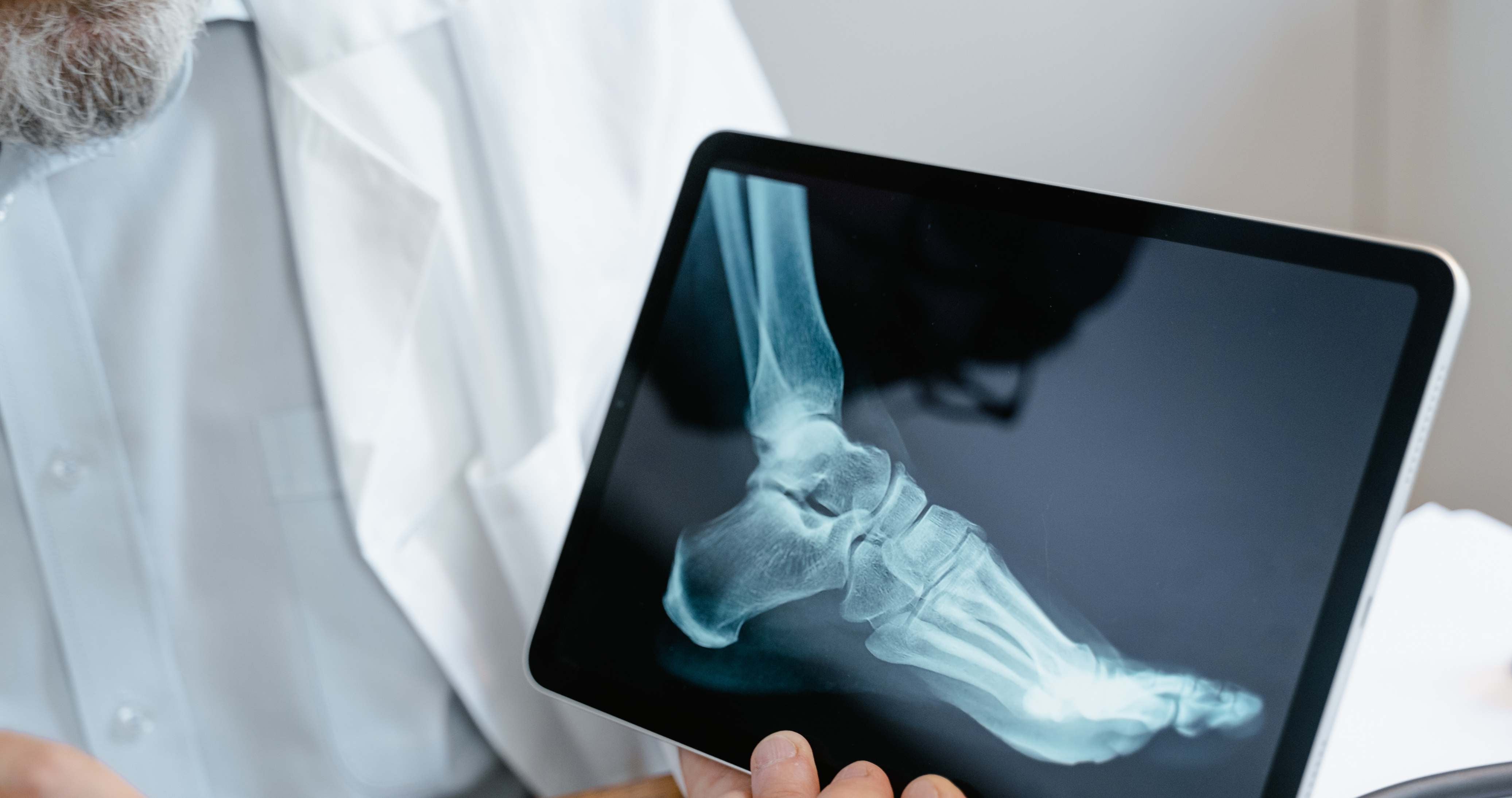 Evde Röntgen Çekimi