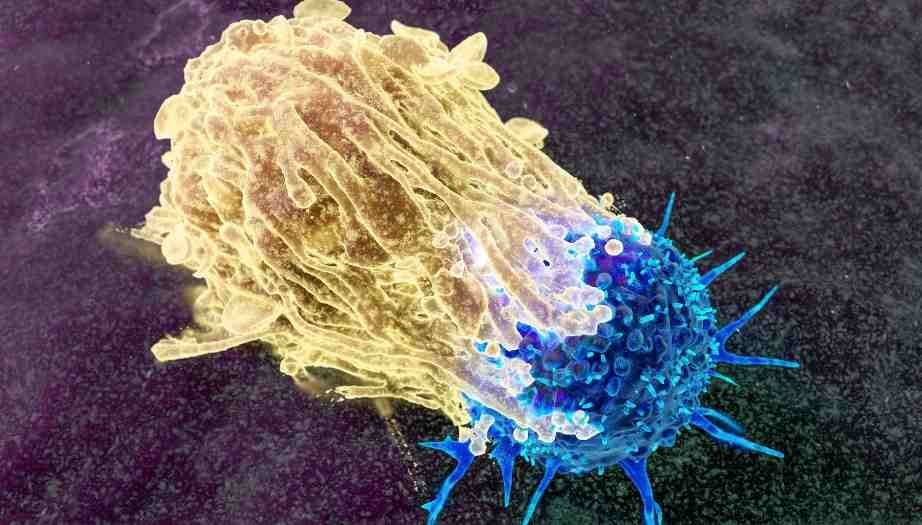 Kanser Riski Genetik Test İle Öğrenilebilir Mi?