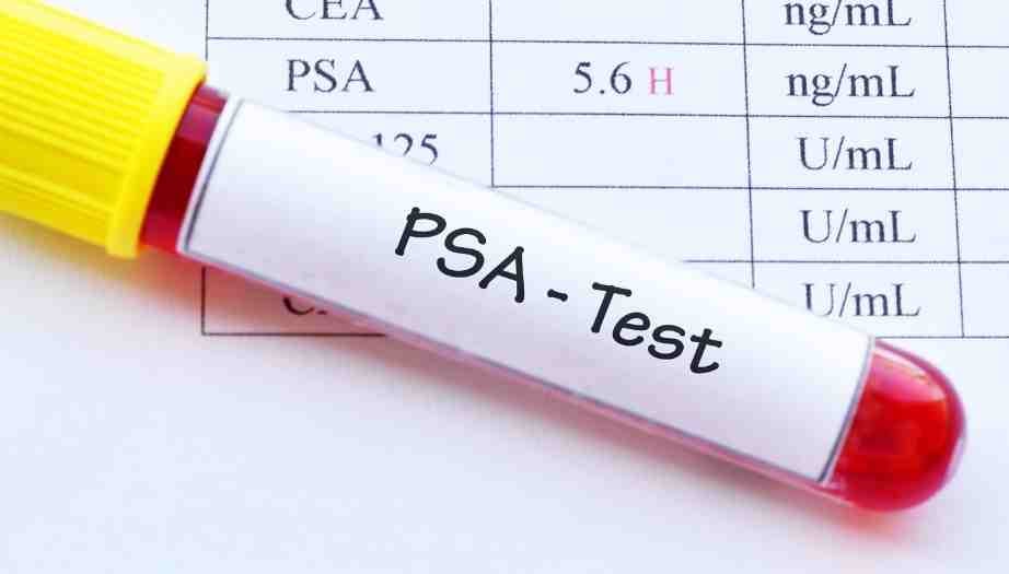 Check-Up’ta PSA Testi Nedir Ve Kimler Yaptırmalı?
