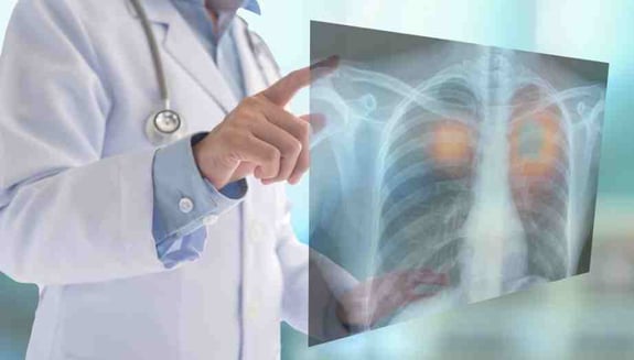 evde röntgen çekimi, taşınabilir röntgen, evde görüntüleme hizmeti, evde sağlık hizmeti, evde tetkik, evde mobil röntgen, evde bakım hastası, happ health