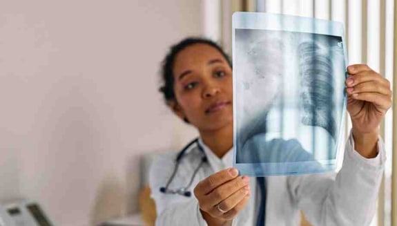 evde röntgen, taşınabilir röntgen cihazı, evde görüntüleme, evde tetkik, evde radyoloji, evde sağlık hizmetleri, happ health