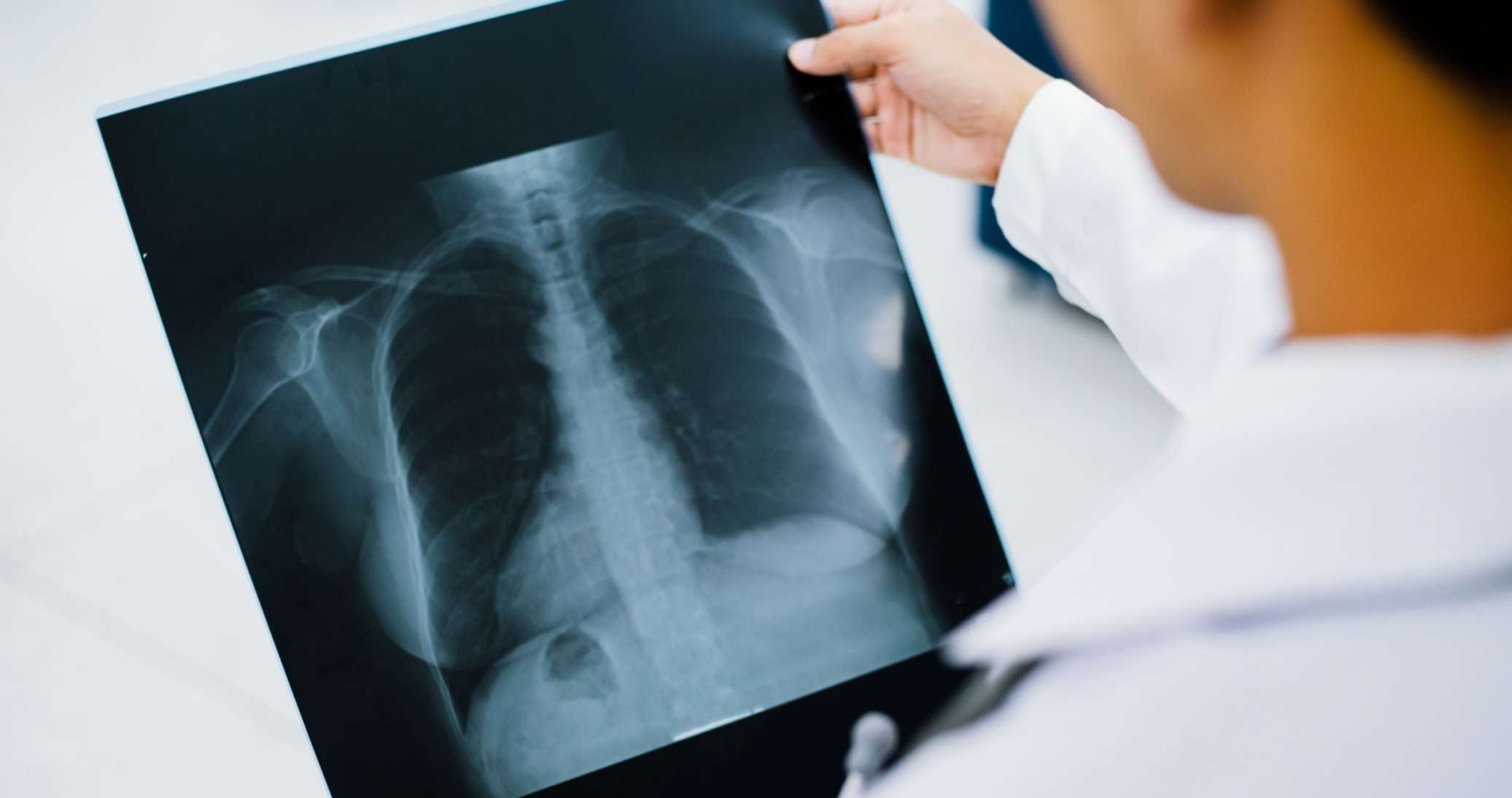 Evde Akciger Grafisi