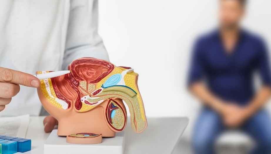 Prostat Kanseri Taraması Kaç Yaşında Başlamalıdır?