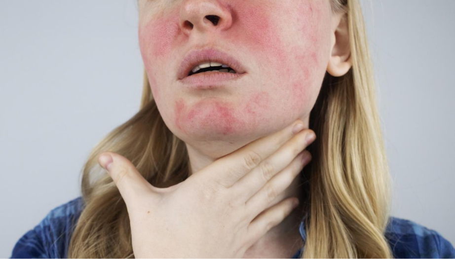 cilt alerjisi, cilt alerjisi belirtileri, ciltte kaşıntı, alerjik döküntü, atopik dermatit, kurdeşen, kontakt dermatit, cilt alerjisi tedavisi, alerji testi, cilt bakımı, doğal cilt ürünleri, alerjen gıdalar, mevsimsel alerji, dermatoloji, bağışıklık sistemi, stres ve alerji, cilt sağlığı, cilt alerjisi nedenleri, cilt alerjisi türleri