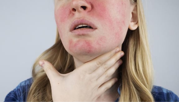 cilt alerjisi, cilt alerjisi belirtileri, ciltte kaşıntı, alerjik döküntü, atopik dermatit, kurdeşen, kontakt dermatit, cilt alerjisi tedavisi, alerji testi, cilt bakımı, doğal cilt ürünleri, alerjen gıdalar, mevsimsel alerji, dermatoloji, bağışıklık sistemi, stres ve alerji, cilt sağlığı, cilt alerjisi nedenleri, cilt alerjisi türleri