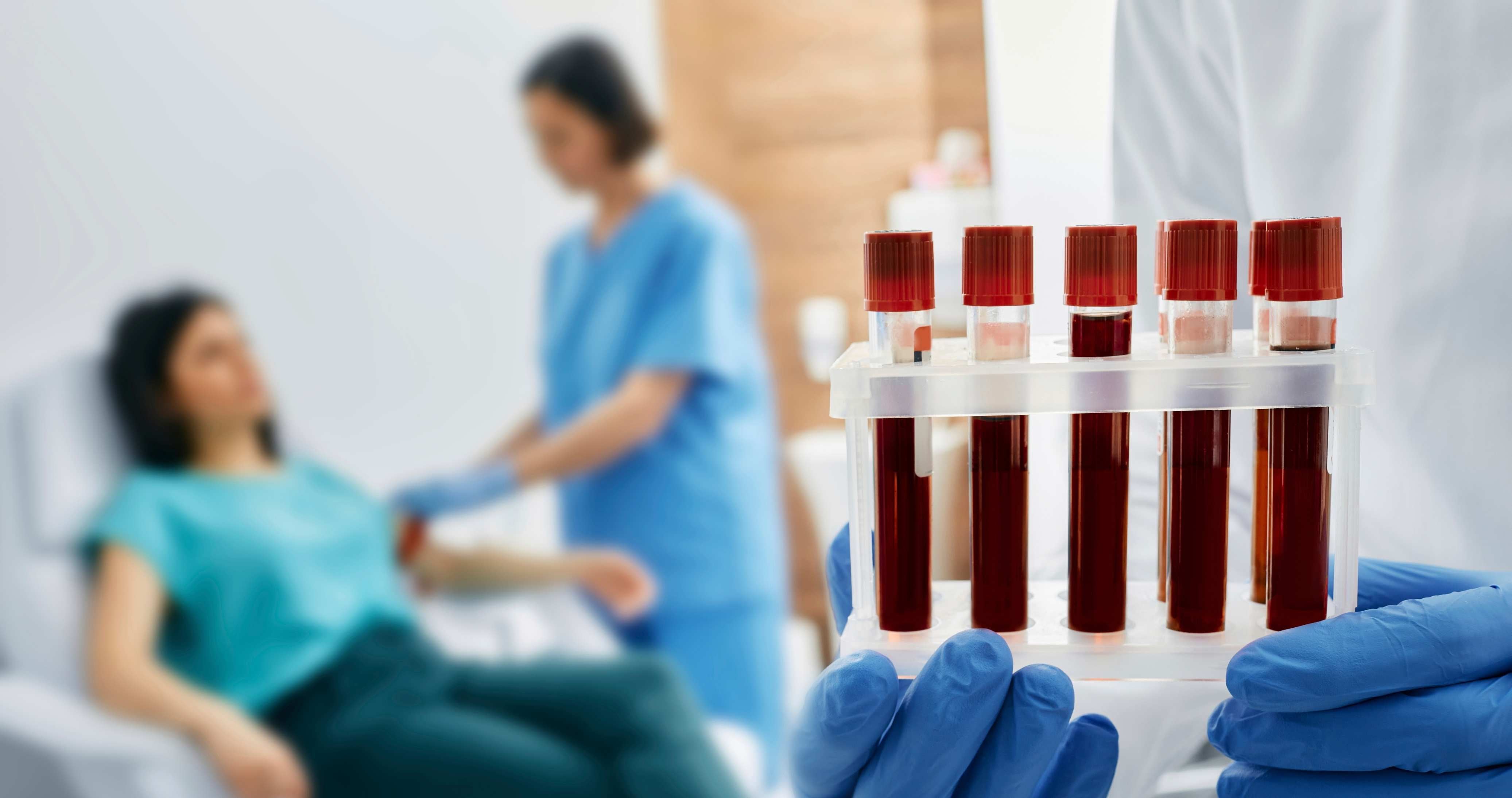 Evde Kapsamlı Kan Alma Paketi