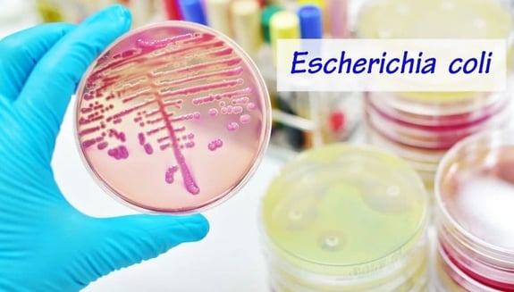 ehec, ehec nedir, ehec belirtileri, ehec tedavisi, ehec bakterisi, ehec virüsü, ehec stec, ehec o157 h7, eiec ehec, ehec enfeksiyonu, ehec hastalığı, shiga toksini, e coli enfeksiyonu, gıda kaynaklı enfeksiyonlar, ehec korunma