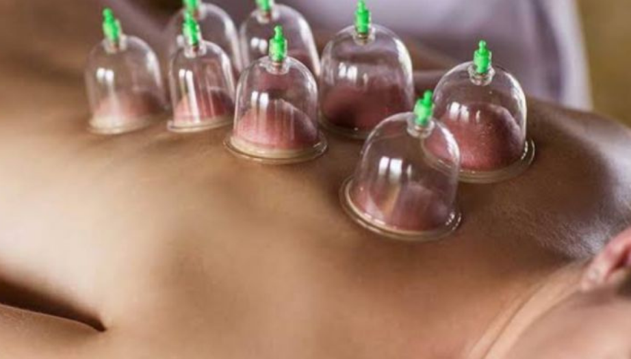 Hacamat Nedir? Nasıl Yapılır?