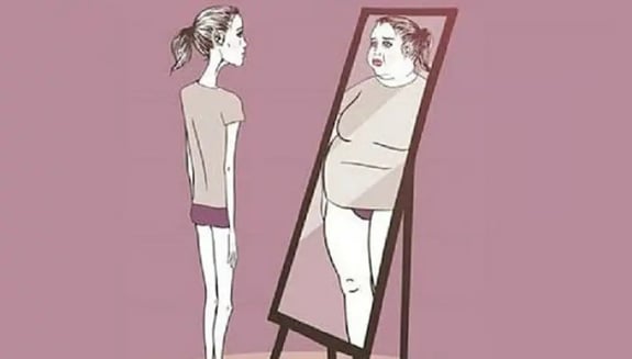 anoreksiya nedir, anoreksiya, anoreksiya nervoza, anoreksiya ne demek, anoreksi, anoreksi nedir, anoreksiya belirtileri, anoreksiya hastalığı nedir, anoreksiya nervoza nedir, anoreksiya nedir tıp, erkeklerde anoreksiya, anoreksiya tanısı, anoreksiya türleri, anoreksiya tedavisi, yeme bozukluğu anoreksiya