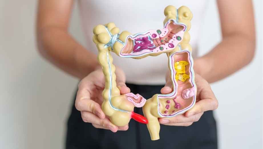 Kolon Kanseri Taraması İçin Check-Up’ta Hangi Testler Yapılır?