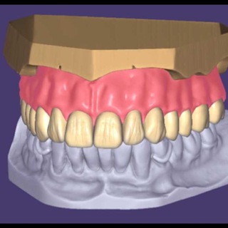 exocad-3shape-cerec expert - TgScanner
