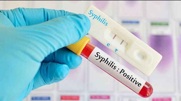 राजनीति गुरु: 70 साल में पहली बार सिफिलिस रोग के सबसे अधिक मामले दर्ज, वैज्ञानिकों ने कहा ये एपिडेमिक का संकेत – अमर उजाला