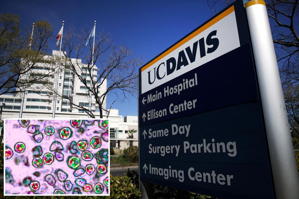 Photo of 300 people possibly exposed to measles after infected child visits California hospital – The News Teller