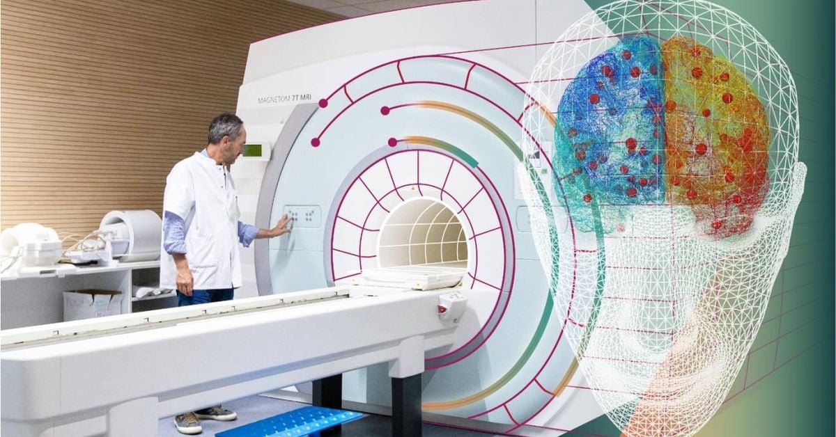 Entre el desafío científico y los nuevos enigmas: así concluye una década de investigación del cerebro en Deporticos