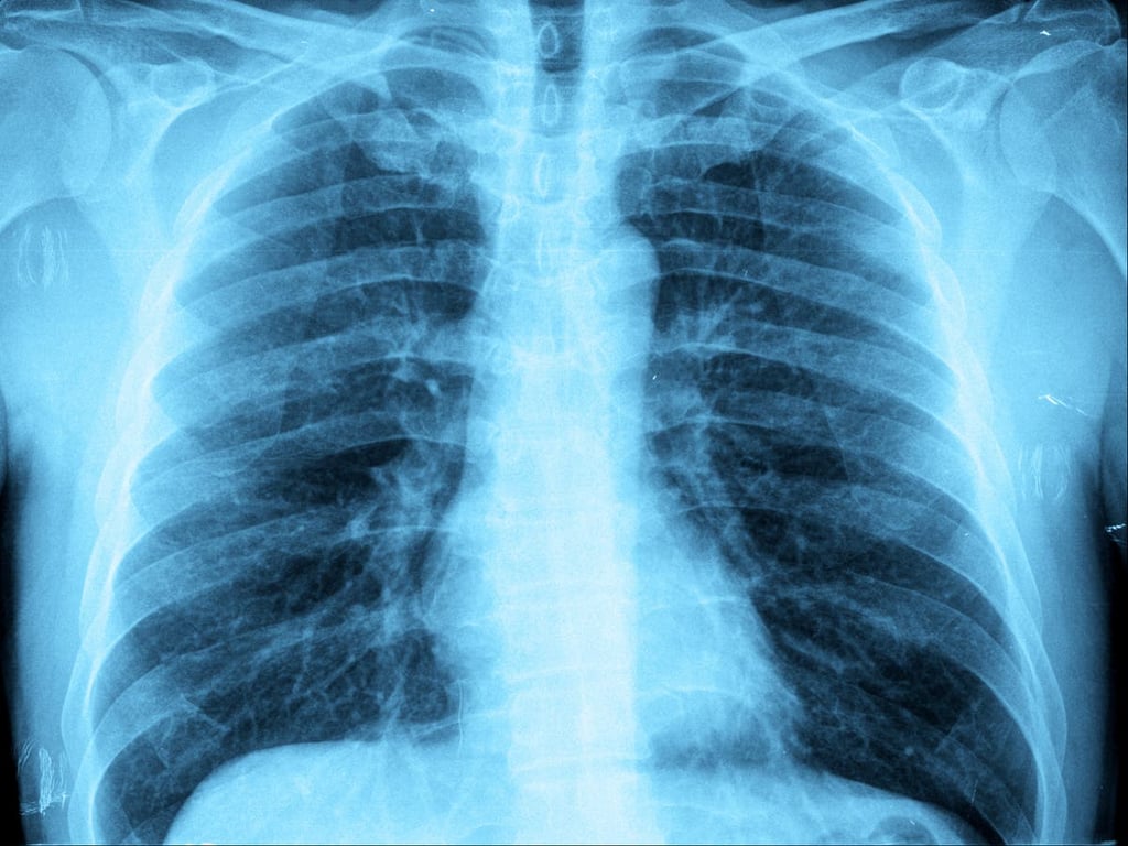 Photo of Unveiling the Mystery of White Lung Pneumonia Affecting Children in Ohio: Recognizing Signs, Symptoms, and More