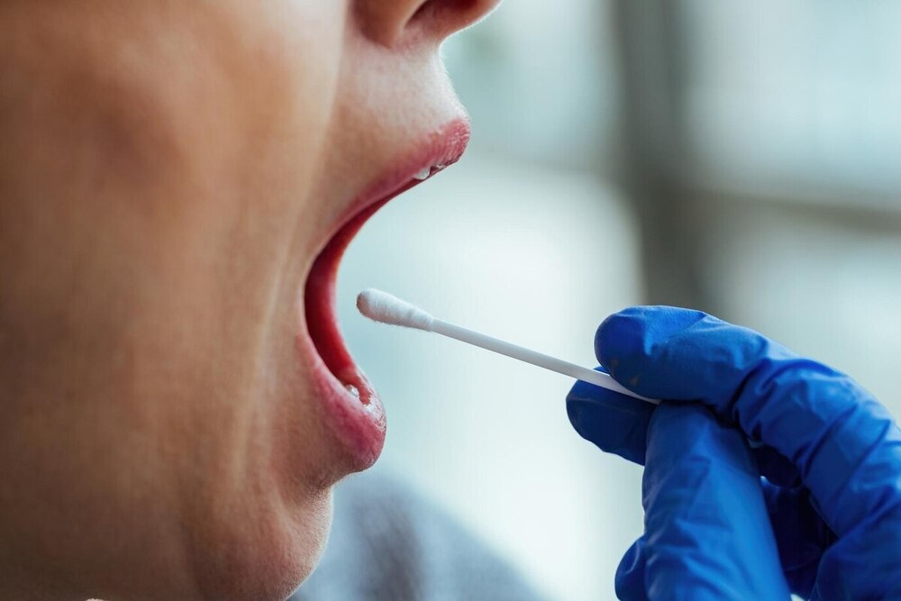 Un test de saliva detecta el cáncer de mama en cinco segundos – Oncenoticias