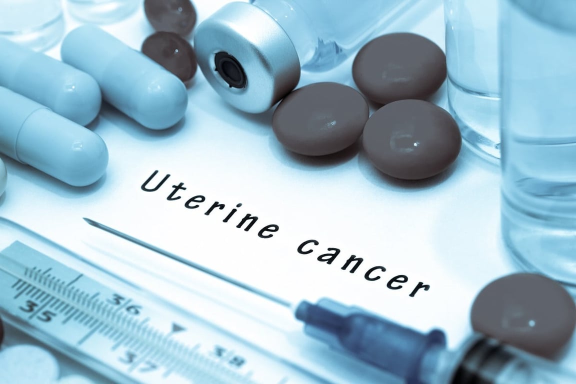 Los iPARP, una revolución en los tratamientos del cáncer de ovario | @diariofarma – Diariofarma