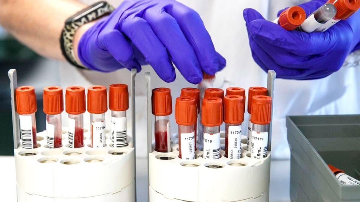 El Instituto de Biomedicina de Sevilla revela características del VIH compatibles con su curació