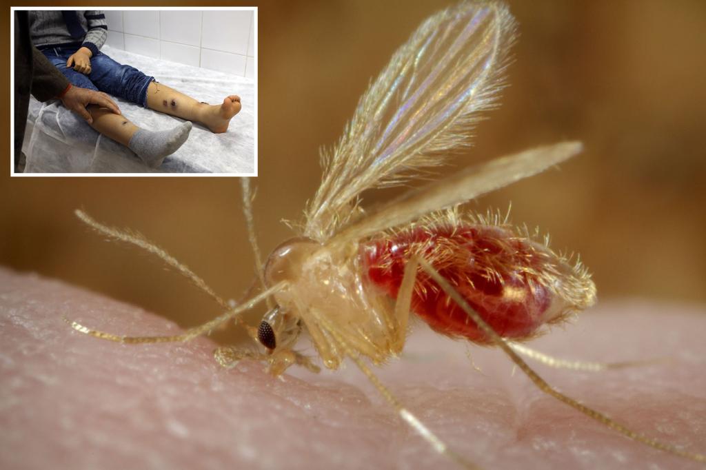 Photo of Tropical Disease Spread by Sand Flies Gains a Foothold in the US: New Report