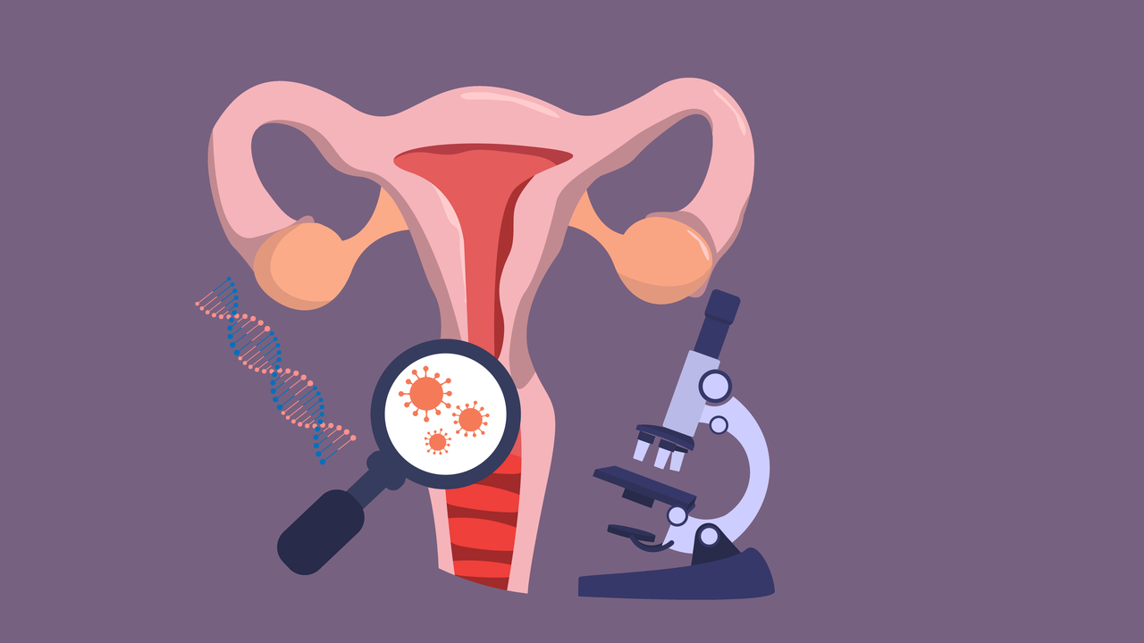 Cáncer de cuello uterino: la vacuna contra el VPH reduce la incidencia de este cáncer hasta en un 73 %