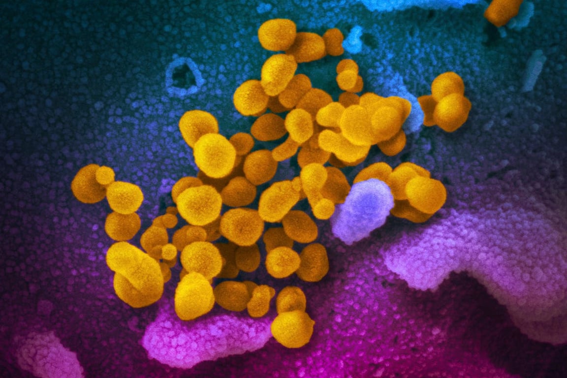 Everything we know about Eris, the Covid variant EG. 5 strain dominating the US as hospitalisations rise