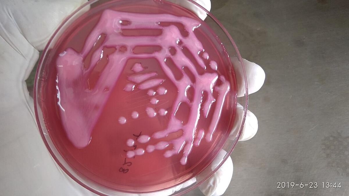 Alerta: Aumentan los casos de Klebsiella pneumoniae, una de las bacterias multirresistentes más peligrosas – Mr. Código
