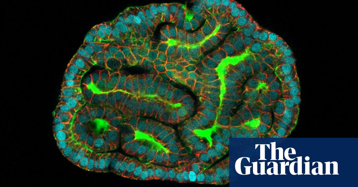 Photo of Scientists Cultivate ‘Mini-Organs’ from Cells Shed by Foetuses in Womb