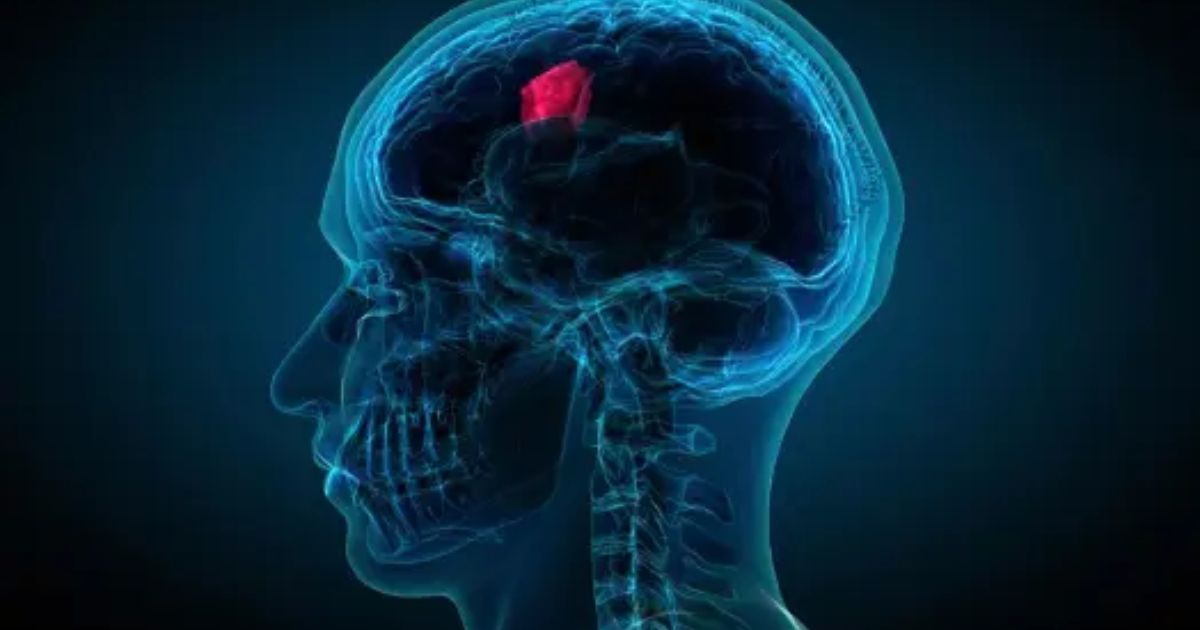 Photo of Terapia celular puede reducir tumores cerebrales agresivos – Oncenoticias