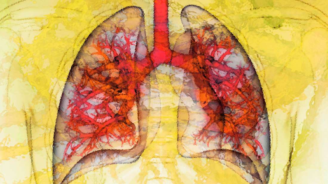 Blut in der Lunge: Hinweis auf 7 ernsthafte Gesundheitsprobleme