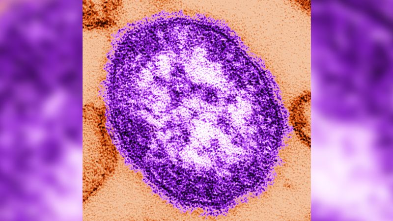 – Measles case count rises to 41 across 16 states, CDC reports