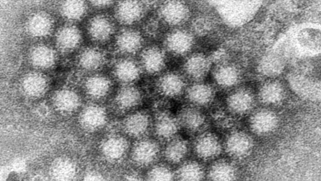 Norovirus outbreak in US leads to more than 1,000 students missing school