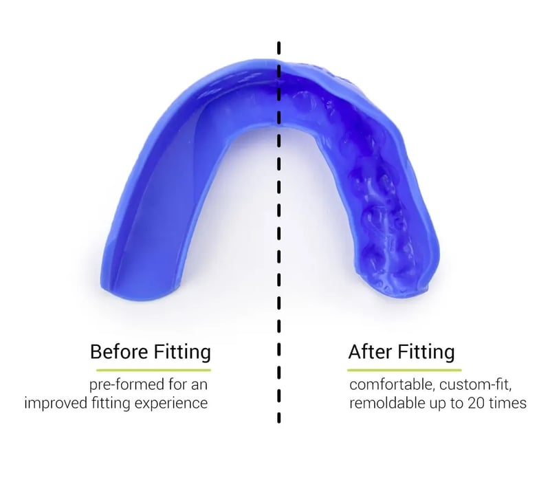 Sisu - 3D Custom Fit Youth - Mouthguard - Lichtblauw