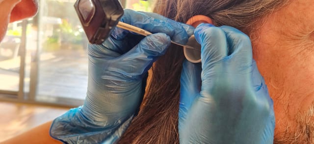  20240903 160028 syringing vs microsuction whats safest for your ears   the audiology place