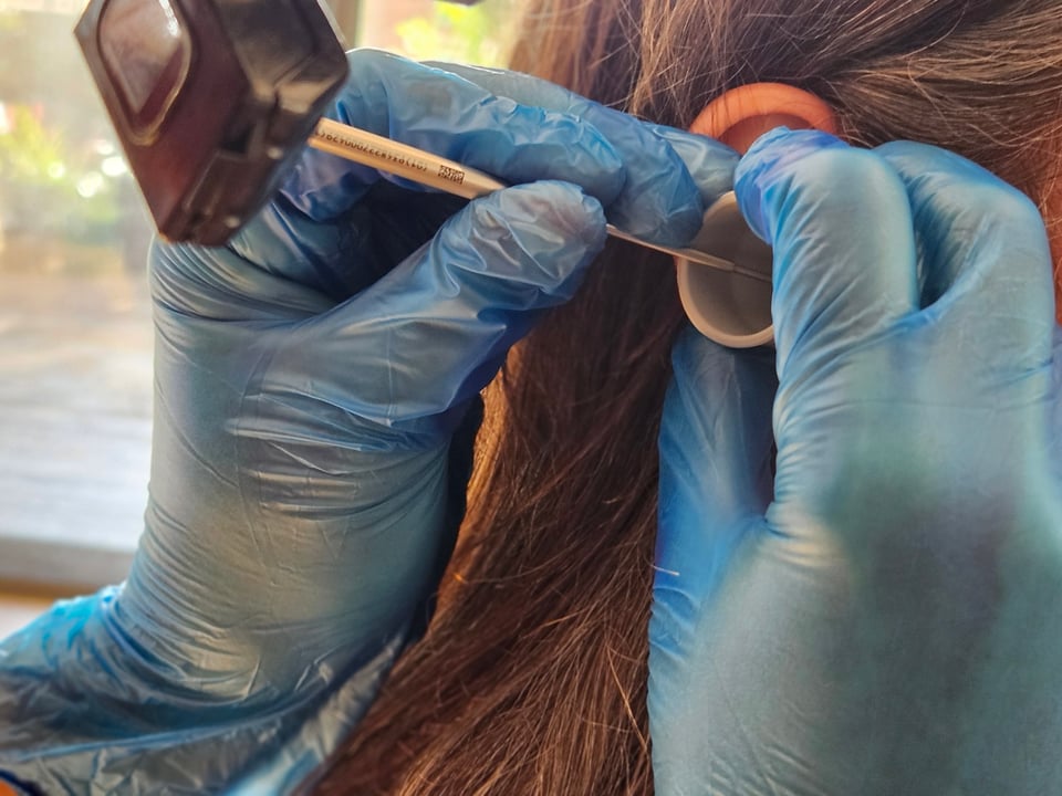 20240903 160028 syringing vs microsuction whats safest for your ears the audiology place