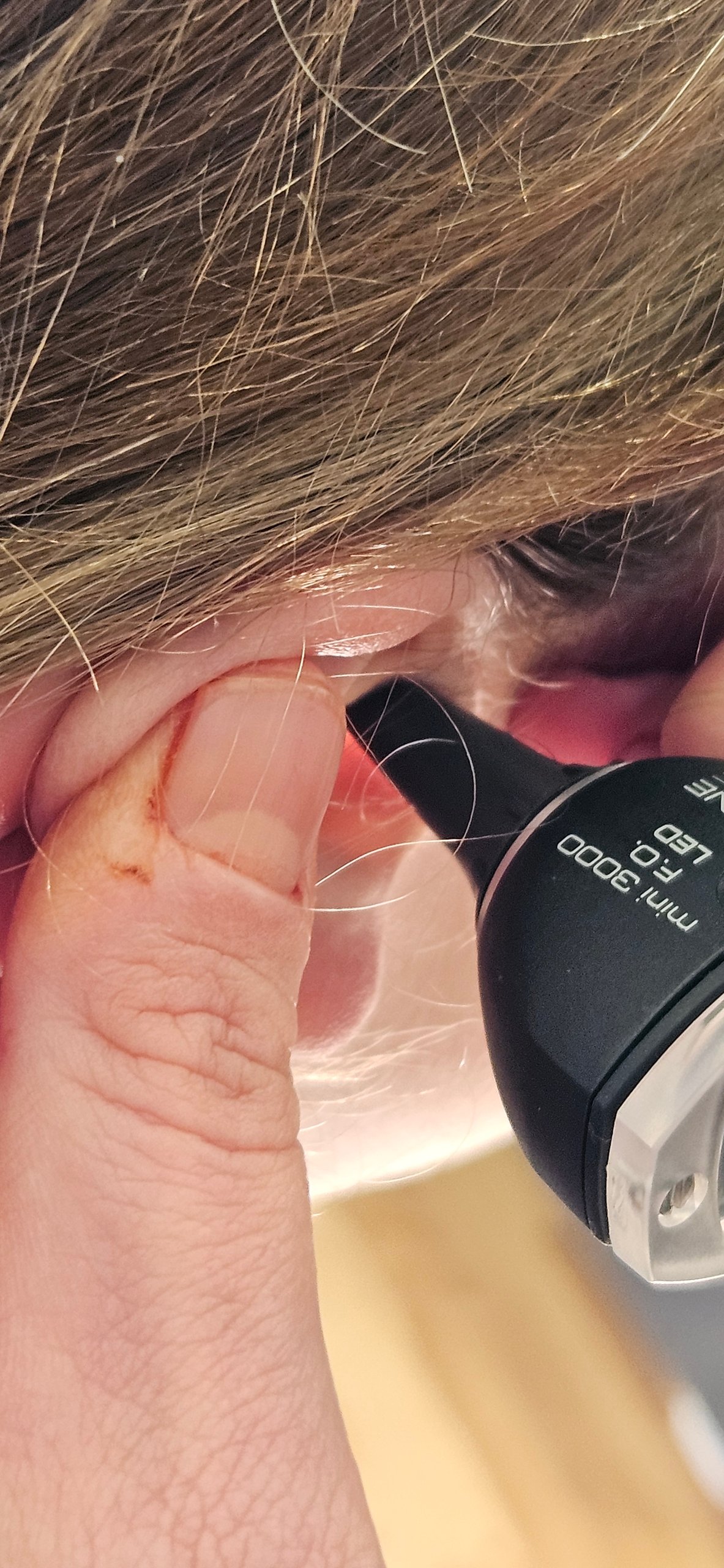  20240903 160956 independent audiologist northern beaches   the audiology place