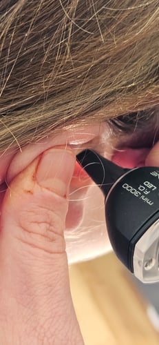 20240903 160956 sydney independent audiologist the audiology place