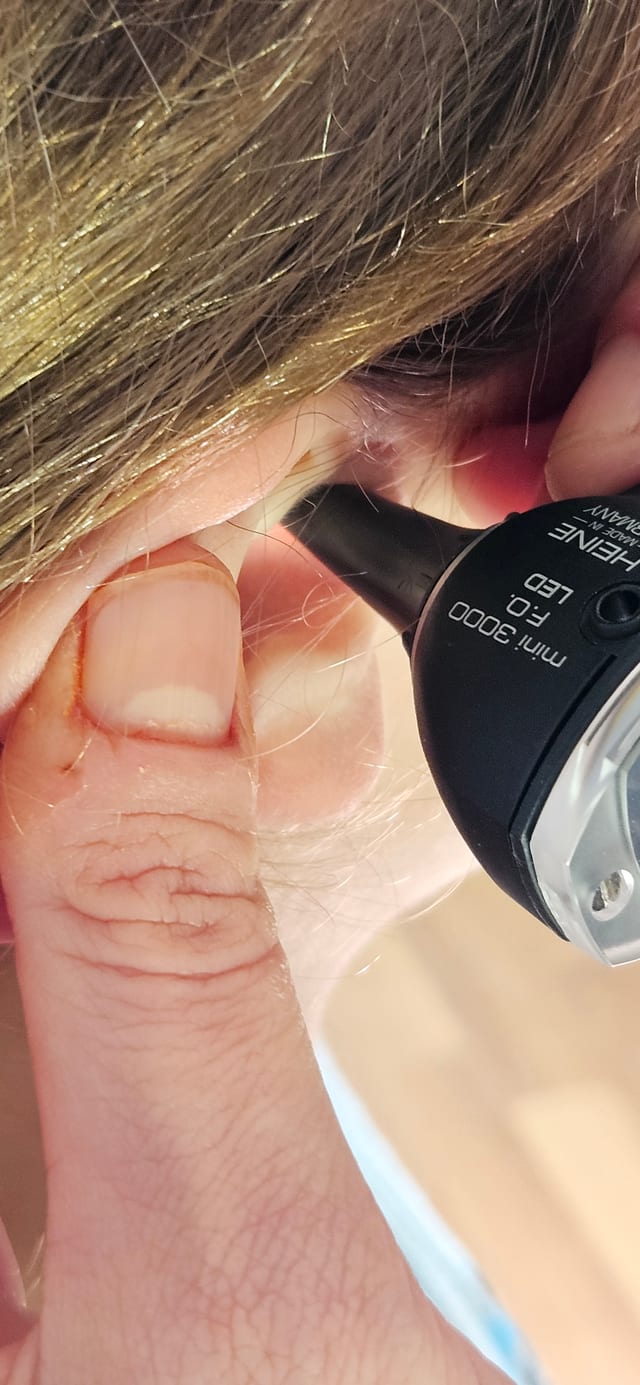  20240903 161003 medicare and hearing aids   the audiology place