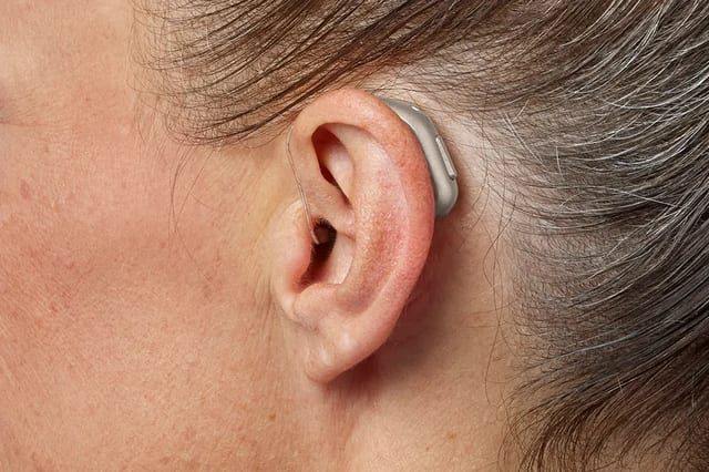  oticon intent minirite h1 2024 c090chromabeige angleb45 close up in on ear ms 6183 woman 1200x800px original file the best hearing aids for tinnitus what really helps the audiology place