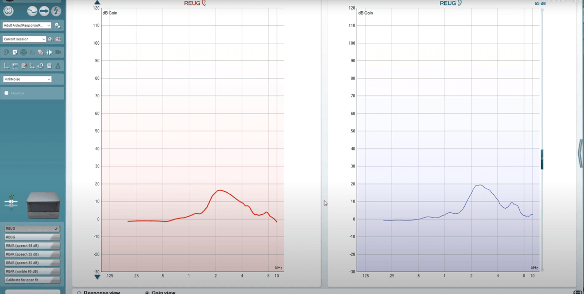 real ear measurements full diagnostic hearing tests sydney the audiology place