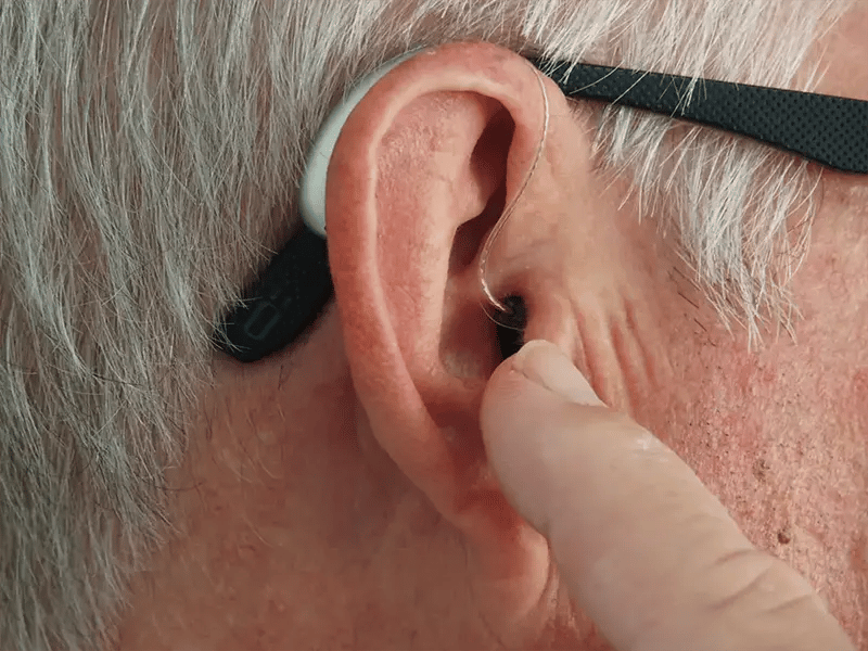 ear-wax-removal-northern-beaches - The Audiology Place ear wax removal northern beaches the audiology place sydney independent hearing clinic