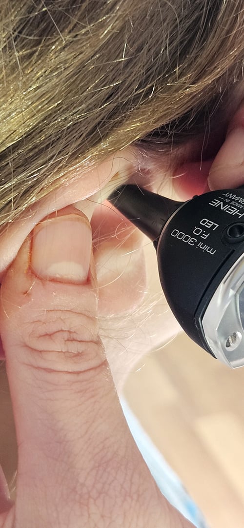 microsuction wax removal doctor 20240903 161003 scaled ear wax removal microsuction   sydney northern beaches