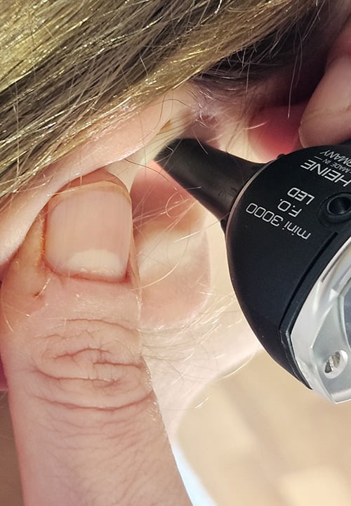 microsuction wax removal doctor 20240903 161003 scaled the audiology place sydney independent hearing clinic